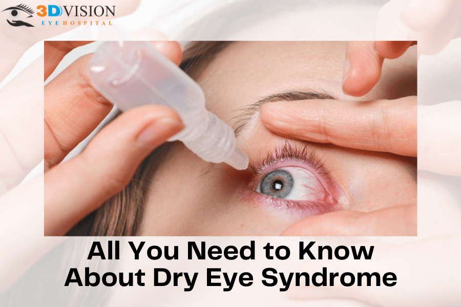 All You Need to Know About Dry Eye Syndrome