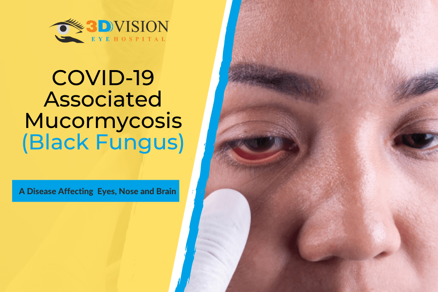 COVID-19 Associated Mucormycosis (Black Fungus): A Disease affecting Eyes, Nose and Brain